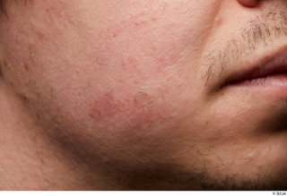 HD Skin Brandon Davis cheek chin face head mustache skin…